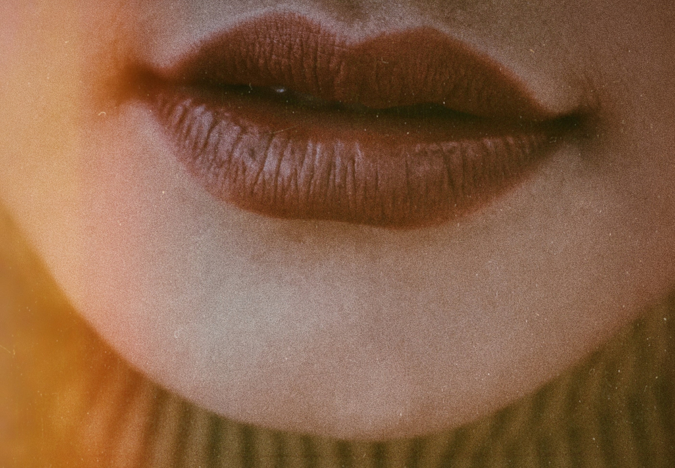 Ustnice